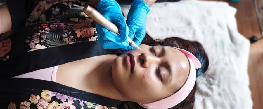 Rejuvenecimiento con Micro Needling en Nemiia Spa Condesa CDMX